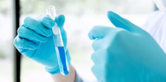 CASAFE: Estadísticas toxicológicas